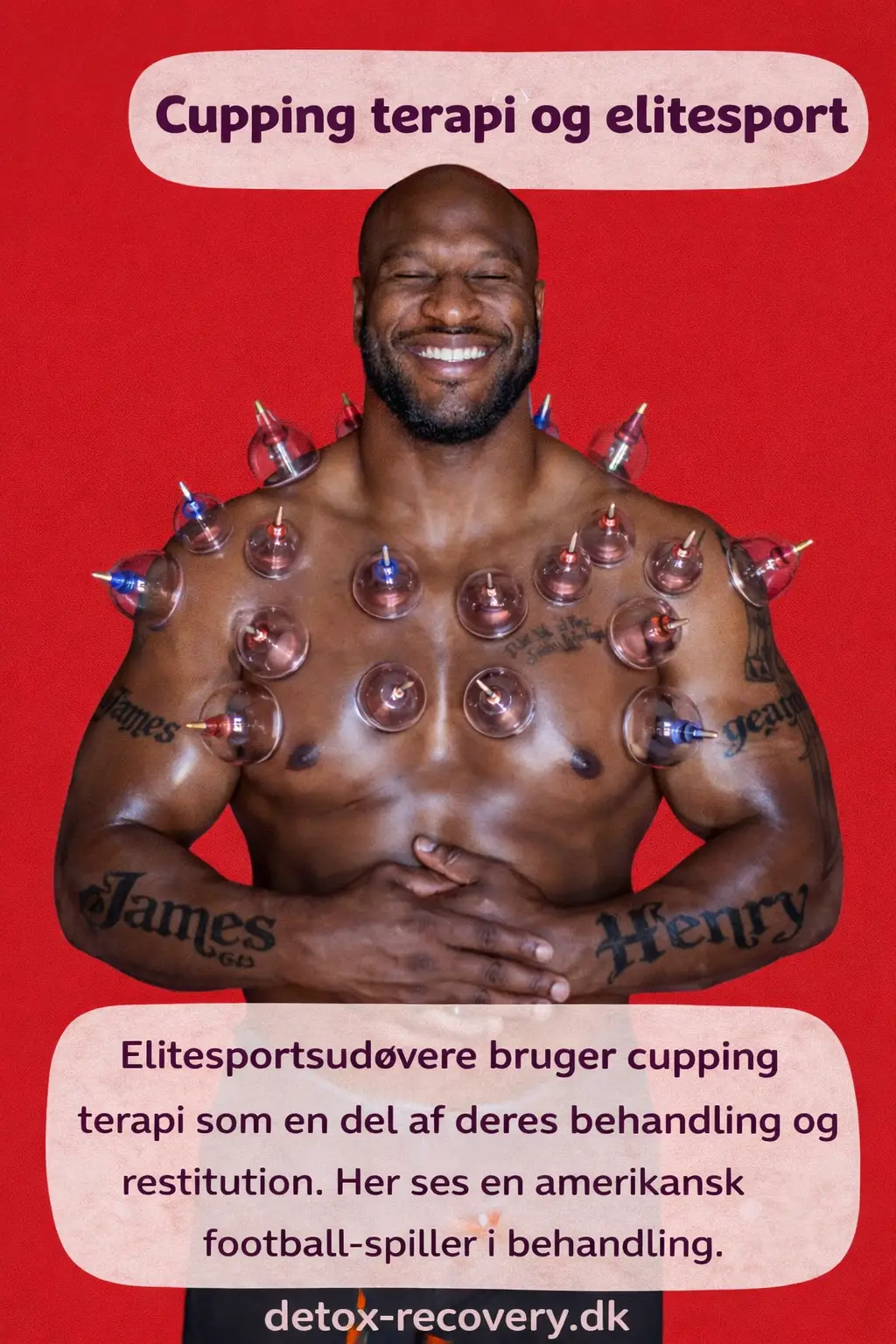 litesportsudøver får cupping terapi som en del af muskelbehandling og restitution